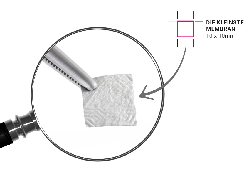 Bild SMARTBRANE Produkt