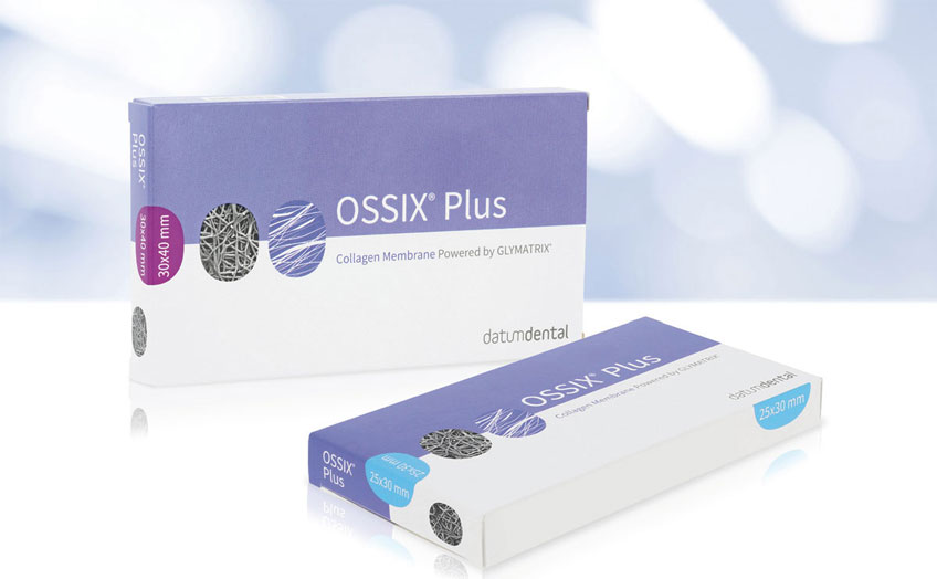 Bild OSSIX Plus Produkt